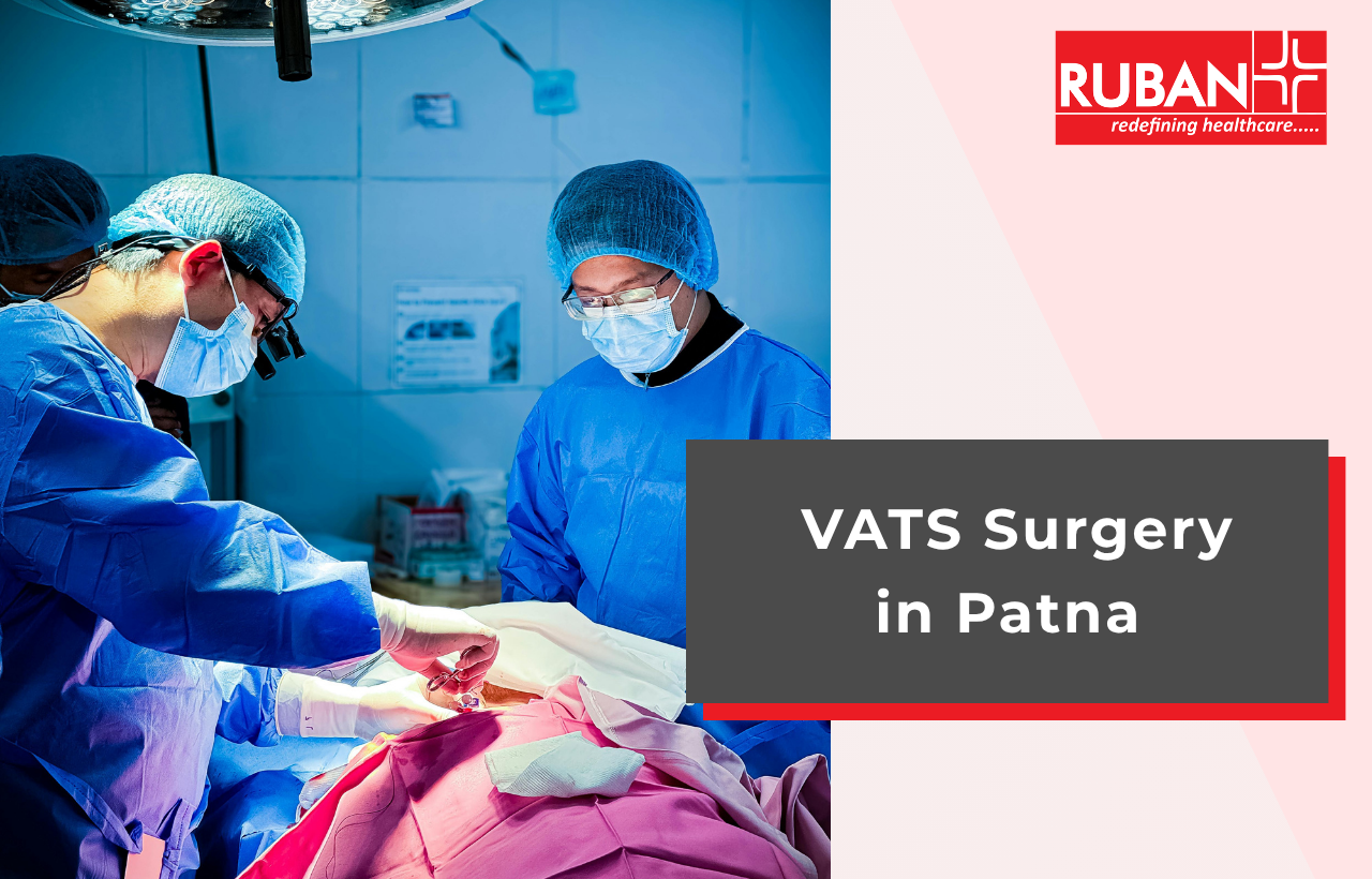 VATS Surgery in Patna | Best Hospital for VATS Surgery in Patna, Bihar